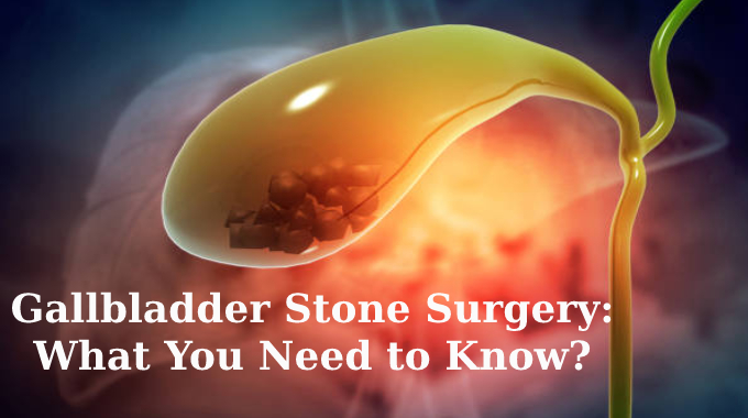 Gallbladder Stone Surgery: What You Need to Know