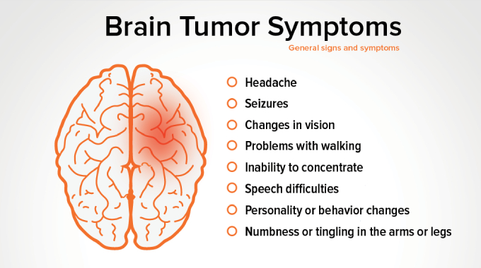 Brain Surgery: Types, Recovery,symptoms & Risk Factors